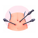 General and Laparoscopic Surgery