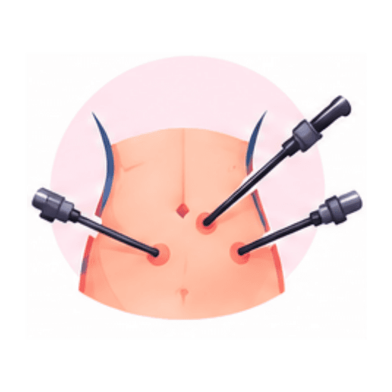 General and Laparoscopic Surgery